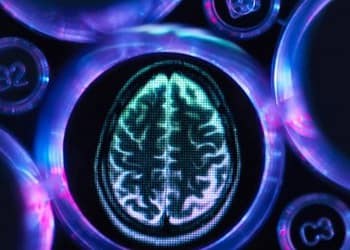 Shkencëtarët krijojnë teknologji të re për identifikimin e Alzheimerit me një saktësi 99 përqind